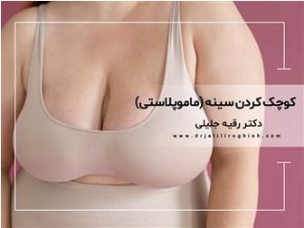 کوچک کردن سینه (ماموپلاستی کاهشی)